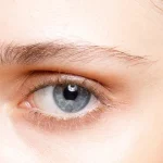 persistent eye bags