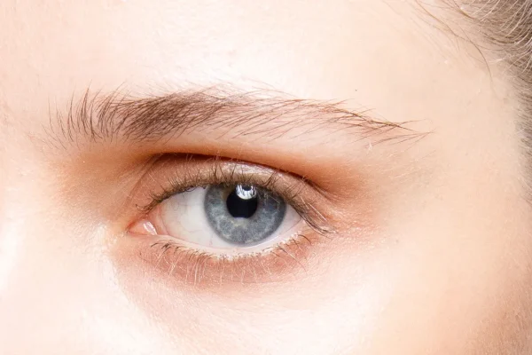 persistent eye bags