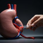 Kidney care